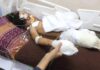Estado genocida de Israel impede acesso de próteses aos amputados de Gaza