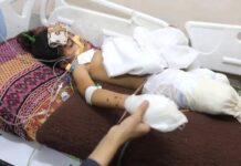 Estado genocida de Israel impede acesso de próteses aos amputados de Gaza