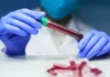 O exame de sangue que pode detectar mais de 50 tipos de câncer