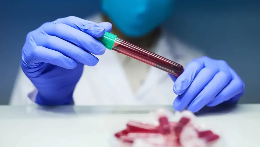exame-de-sangue-sao-camilo