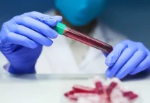 O exame de sangue que pode detectar mais de 50 tipos de câncer